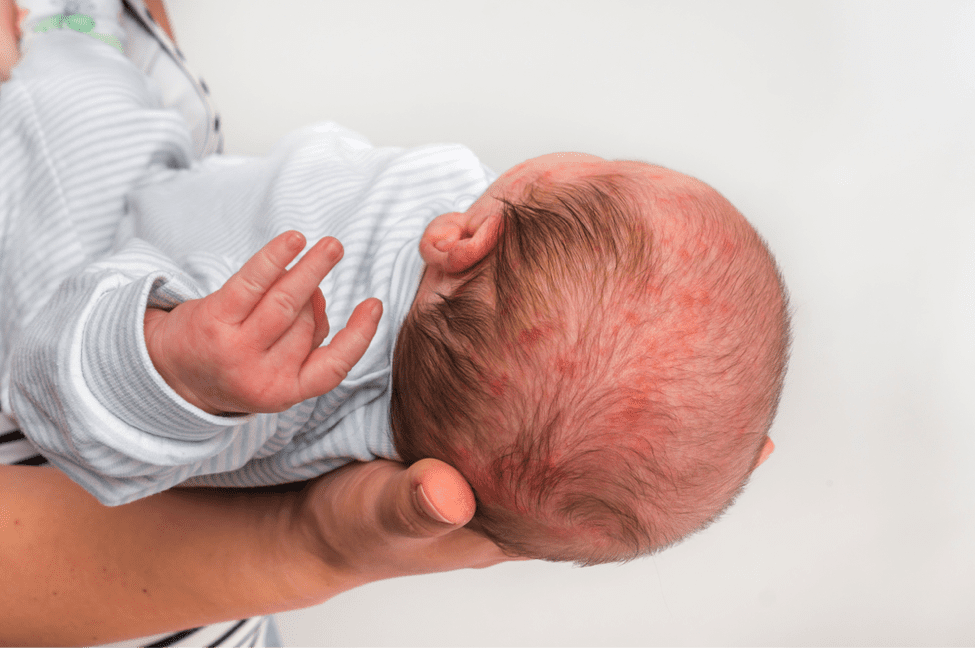 birth injury claims